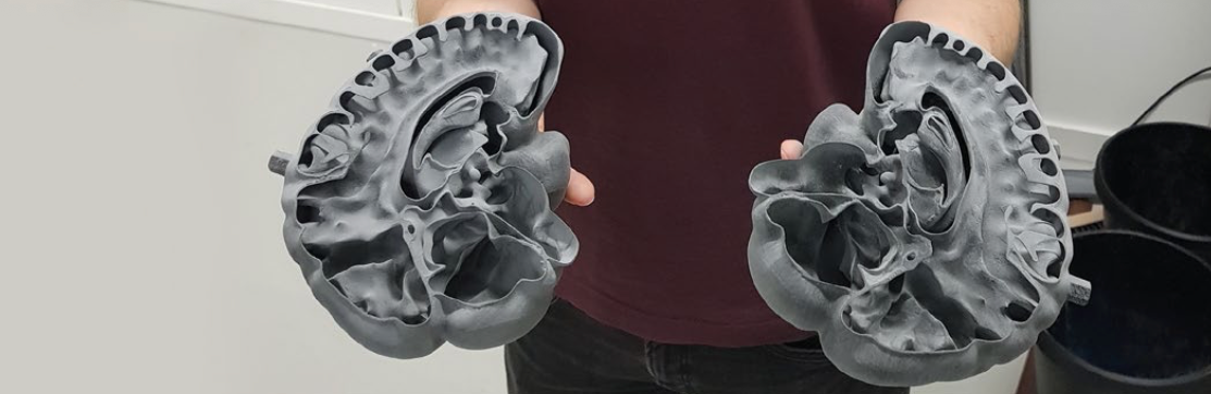 3D printed brain phantom produced on a Sinterit Lisa PRO at the Institute for Multiscale Simulation for SPECT imaging research