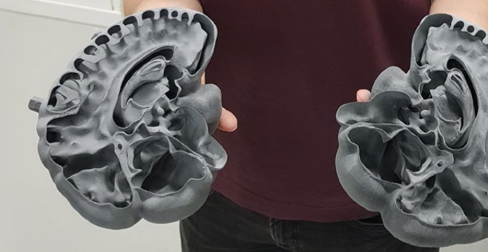 3D printed brain phantom produced on a Sinterit Lisa PRO at the Institute for Multiscale Simulation for SPECT imaging research